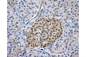 Immunohistochemical staining of paraffin-embedded liver tissue using anti-CAPZA1 mouse monoclonal antibody.