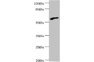 Western blot All lanes: RBBP5 antibody at 6 μg/mL + HepG2 whole cell lysate Secondary Goat polyclonal to rabbit IgG at 1/10000 dilution Predicted band size: 60, 56 kDa Observed band size: 60 kDa (RBBP5 抗体  (AA 319-538))