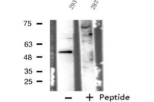 Western blot analysis of extracts from 293 cells, using IP6K3 antibody. (IP6K3 抗体  (Internal Region))