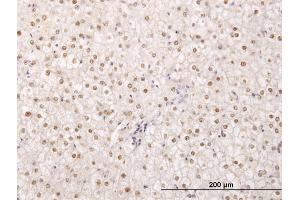 Immunoperoxidase of monoclonal antibody to TPRX1 on formalin-fixed paraffin-embedded human liver. (TPRX1 抗体  (AA 313-411))