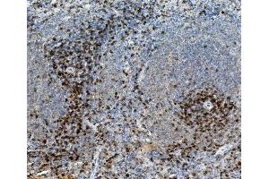 IHC analysis of CD8 alpha/Cd8a using anti-CD8 alpha/Cd8a antibody (ABIN7601570). (CD8 alpha 抗体  (AA 39-245))