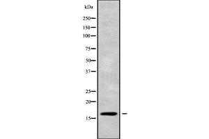 Western blot analysis of CST5 using NIH-3T3 whole cell lysates (CST5 抗体  (Internal Region))