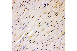 Anti- MSK1 Picoband antibody, IHC(P) IHC(P): Mouse Cardiac Muscle Tissue (MSK1 抗体  (AA 540-665))