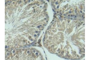 Detection of IGFBP3 in Rat Testis Tissue using Polyclonal Antibody to Insulin Like Growth Factor Binding Protein 3 (IGFBP3) (IGFBP3 抗体  (AA 137-274))