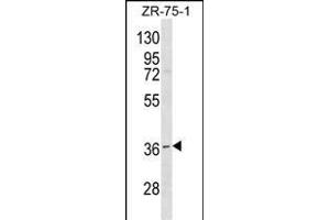 RNF144B Antibody (Center) (ABIN1538681 and ABIN2850060) western blot analysis in ZR-75-1 cell line lysates (35 μg/lane). (RNF144B 抗体  (AA 90-118))