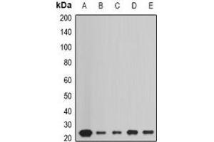 Western blot analysis of Peroxiredoxin 1 expression in HepG2 (A), Hela (B), A549 (C), mouse liver (D), mouse heart (E) whole cell lysates. (Peroxiredoxin 1 抗体)