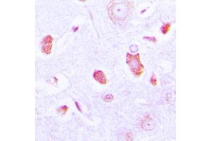 Immunohistochemical analysis of GUCY1A3 staining in human brain formalin fixed paraffin embedded tissue section. (GUCY1A1 抗体  (Center))