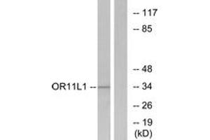 Western blot analysis of extracts from LOVO cells, using OR11L1 Antibody. (OR11L1 抗体  (AA 201-250))
