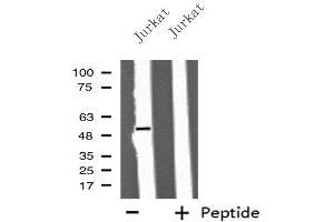 Western blot analysis of extracts from Jurkat cells, using IFIT5 antibody. (IFIT5 抗体  (Internal Region))