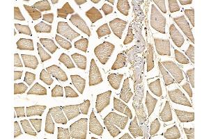 ABIN7097138 and ABIN7101206 at 1/100 staining rat muscle tissue by IHC-P. (Leucine Rich Repeat and Coiled-Coil Domain Containing 1 (LRRCC1) 抗体)