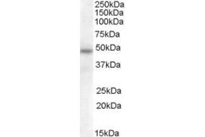 Image no. 1 for anti-serpin Peptidase Inhibitor, Clade A (Alpha-1 Antiproteinase, Antitrypsin), Member 12 (SERPINA12) (Internal Region) antibody (ABIN263213)