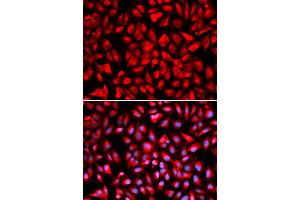 Immunofluorescence analysis of U2OS cells using IPO5 antibody (ABIN5971032). (Importin 5 抗体)