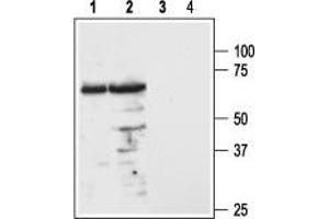 Western blot analysis of mouse (lanes 1 and 3) and rat (lanes 2 and 4) brain lysates: - 1,2. (MC3R 抗体  (1st Extracellular Loop))