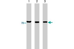 Western blot analysis using MARK3 polyclonal antibody on His-tagged c-tak1 (lane 1), RKO cell lysate (lane 2) and HCT-116 cell lysate (lane 3). (MARK3 抗体)
