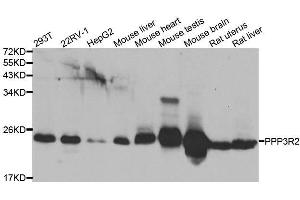 Western blot analysis of extracts of various cell lines, using PPP3R2 antibody. (Calcineurin B 抗体  (AA 1-173))