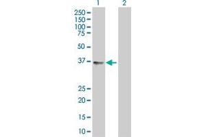 Western Blotting (WB) image for CISH 293T Cell Transient Overexpression Lysate(Denatured) (ABIN1331358)