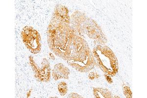 anti-Dipeptidyl-Peptidase 4 (DPP4) (AA 29-766) antibody