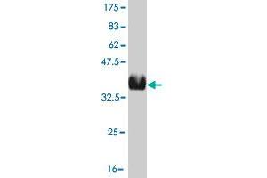 Western Blot detection against Immunogen (36. (Recoverin 抗体  (AA 101-199))