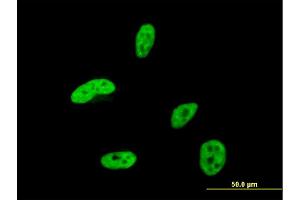 Immunofluorescence of monoclonal antibody to HOXA9 on HeLa cell. (HOXA9 抗体  (AA 1-272))