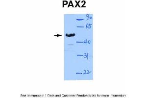 WB Suggested Anti-PAX2 Antibody Titration: 1. (PAX2A 抗体  (Middle Region))