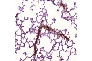 IHC testing of FFPE human lung tissue with C-Reactive Protein antibody at 2ug/ml. (CRP 抗体  (AA 20-230))