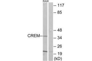 Western blot analysis of extracts from K562 cells, using CREM antibody.