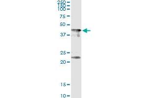 Immunoprecipitation of CENPJ transfected lysate using anti-CENPJ monoclonal antibody and Protein A Magnetic Bead , and immunoblotted with CENPJ MaxPab rabbit polyclonal antibody. (CENPJ 抗体  (AA 979-1088))
