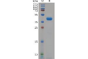 KCNK9 Protein (AA 30-79) (Fc Tag)