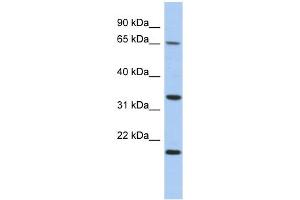 WB Suggested Anti-FAM79B Antibody Titration: 0. (TPRG1 抗体  (N-Term))