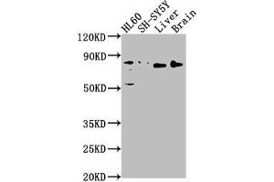 Western Blot Positive WB detected in: HL60 whole cell lysate, SH-SY5Y whole cell lysate, Rat liver tissue, Rat brain tissue All lanes: DNAJC10 antibody at 1:1000 Secondary Goat polyclonal to rabbit IgG at 1/50000 dilution Predicted band size: 92, 87, 38 kDa Observed band size: 80 kDa (DNAJC1 抗体  (AA 521-793))