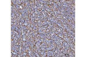 IHC analysis of SAV1 using anti-SAV1 antibody (ABIN7602478).