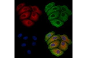 ABIN6257497 and ABIN6275601 staining Hela cells by IF/ICC. (Sorting Nexin 3 抗体  (Internal Region))