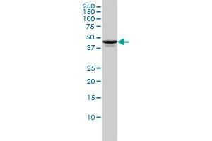 TSSK2 monoclonal antibody (M01), clone 1E12 Western Blot analysis of TSSK2 expression in HL-60 . (TSSK2 抗体  (AA 1-358))