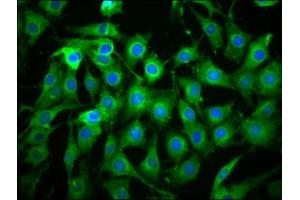Immunofluorescence staining of NIH/3T3 cells with ABIN7166183 at 1:133, counter-stained with DAPI. (C1orf38 抗体  (AA 62-177))