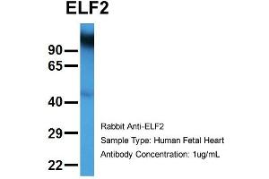 Host:  Rabbit  Target Name:  ELF2  Sample Type:  Human Fetal Heart  Antibody Dilution:  1. (ELF2 抗体  (N-Term))