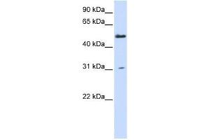 AGXT2L2 antibody used at 0. (AGXT2L2 抗体  (N-Term))