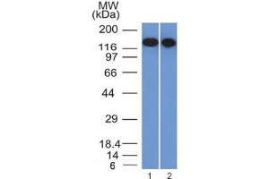 Western blot testing of FFPE human 1) Raji and 2) Ramos cell lysate with CD22 antibody (clone BLCAM/1795). (CD22 抗体  (AA 52-178))