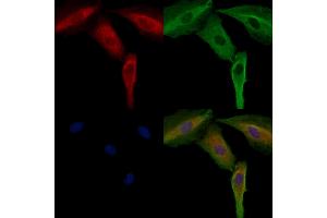 ABIN6264545 and ABIN6272404 staining  cells by IF/ICC. (SIK3 抗体  (Internal Region))