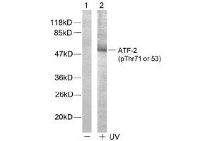 Image no. 2 for anti-Activating Transcription Factor 2 (ATF2) (pThr53), (pThr71) antibody (ABIN196666) (ATF2 抗体  (pThr53, pThr71))