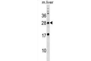 Western Blotting (WB) image for anti-Myelin Protein Zero-Like 3 (MPZL3) antibody (ABIN3000006) (MPZL3 抗体)