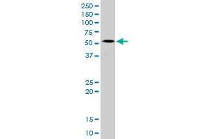 MYCN MaxPab rabbit polyclonal antibody. (MYCN 抗体  (AA 1-464))
