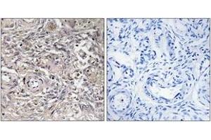 Immunohistochemistry analysis of paraffin-embedded human ovary tissue, using CLDN6 Antibody. (Claudin 6 抗体  (AA 81-130))