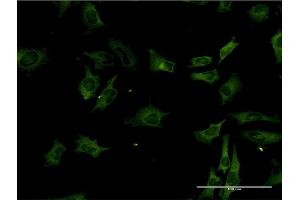 Immunofluorescence (IF) image for anti-serine/threonine Kinase 3 (STK3) (AA 311-431) antibody (ABIN520576)