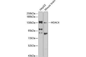Western blot analysis of extracts of various cell lines, using HD antibody (ABIN6128012, ABIN6141669, ABIN6141672 and ABIN6213648) at 1:1000 dilution. (HDAC4 抗体  (AA 451-650))