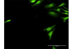 Immunofluorescence of purified MaxPab antibody to UBE2G2 on HeLa cell. (UBE2G2 抗体  (AA 1-137))