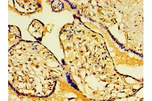 Immunohistochemistry of paraffin-embedded human placenta tissue using ABIN7154837 at dilution of 1:100 (FAM29A 抗体  (AA 676-955))