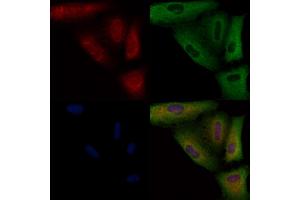 ABIN6258296 and ABIN6274603 staining  cells by IF/ICC. (P-Cadherin 抗体  (N-Term))