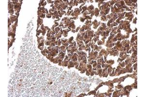 IHC-P Image alpha SNAP antibody [N2C3] detects alpha SNAP protein at cytosol on mouse lung by immunohistochemical analysis. (NAPA 抗体  (Center))