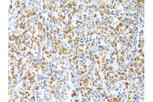 Immunohistochemistry of paraffin-embedded rat ovary using S100A10 antibody.