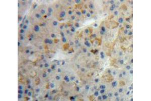 IHC-P analysis of Liver tissue, with DAB staining. (LALBA 抗体  (AA 12-142))